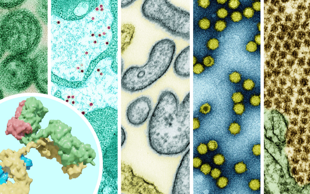 Preparing for the next pandemic: a Universal flu vaccine