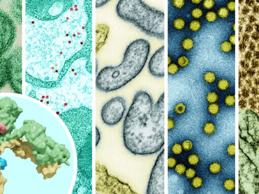 Preparing for the next pandemic: a Universal flu vaccine Preparing for the next pandemic: a Universal flu vaccine