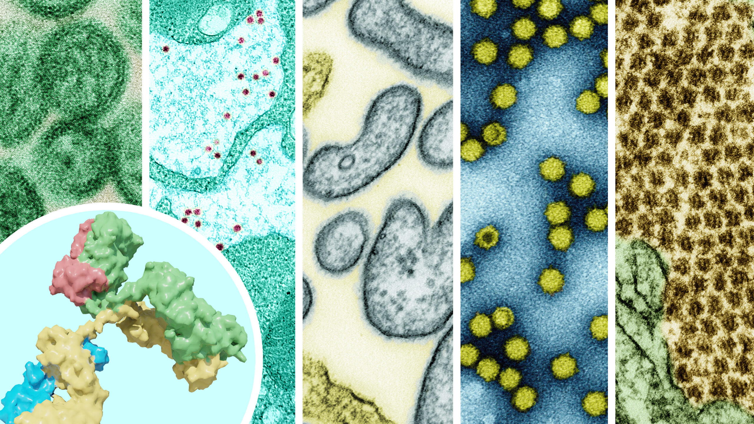 Preparing for the next pandemic: a Universal flu vaccine